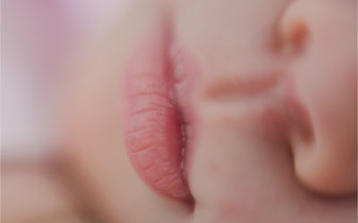 Baby born without nose