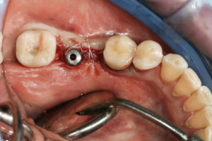 oral surgery services