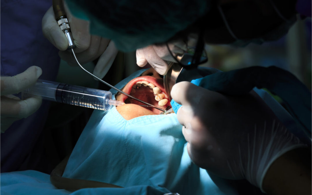 Common Oral Surgery Services