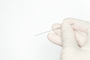 dry needling effectiveness