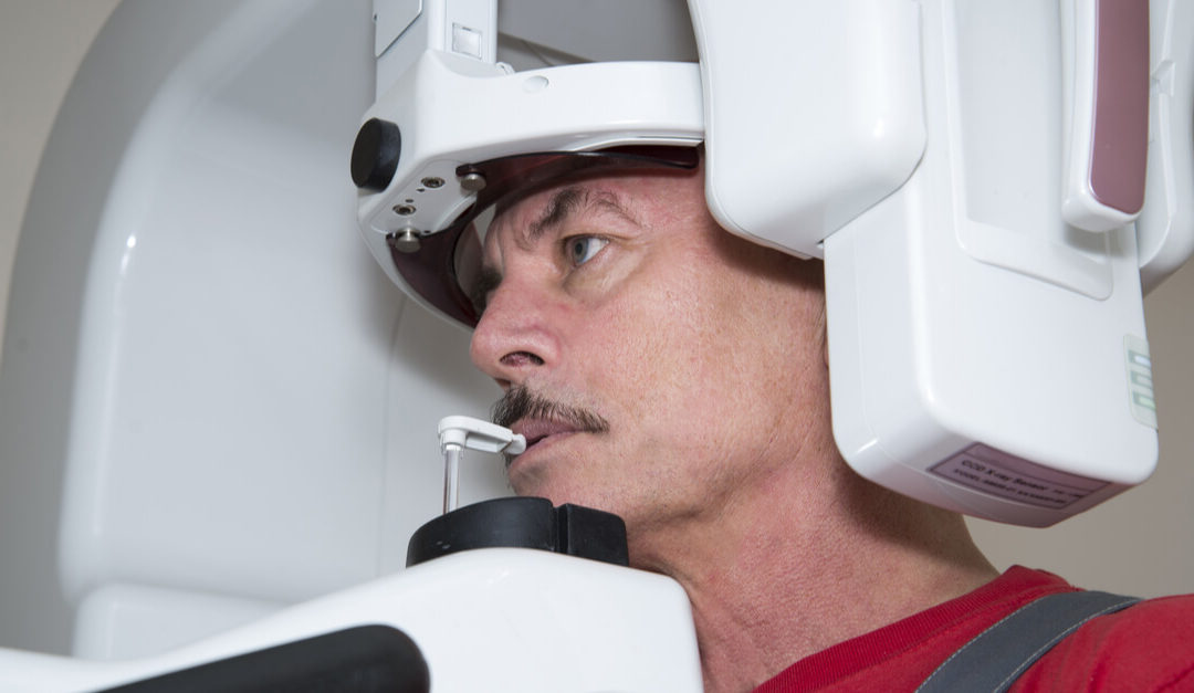 Xray for Wisdom Tooth