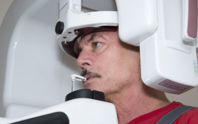 Xray for Wisdom Tooth