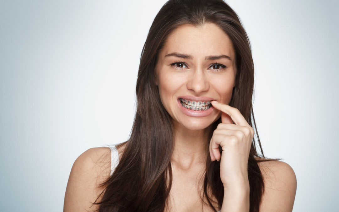 Are 6 month braces effective?