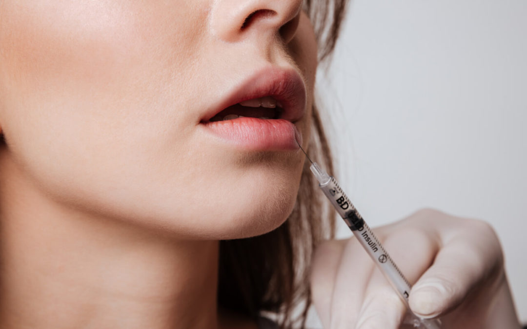 Facts to know about lip filler swelling