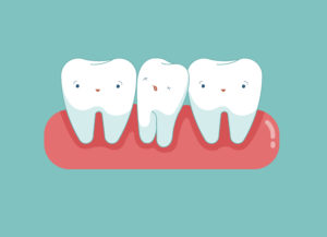 causes of crooked teeth
