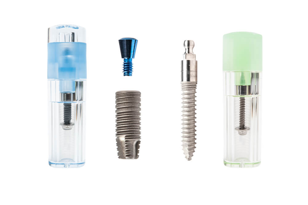 Ideal Implant Types For Your Dental Surgeries