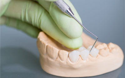 What To Do To Fix A Broken Dental Bridge