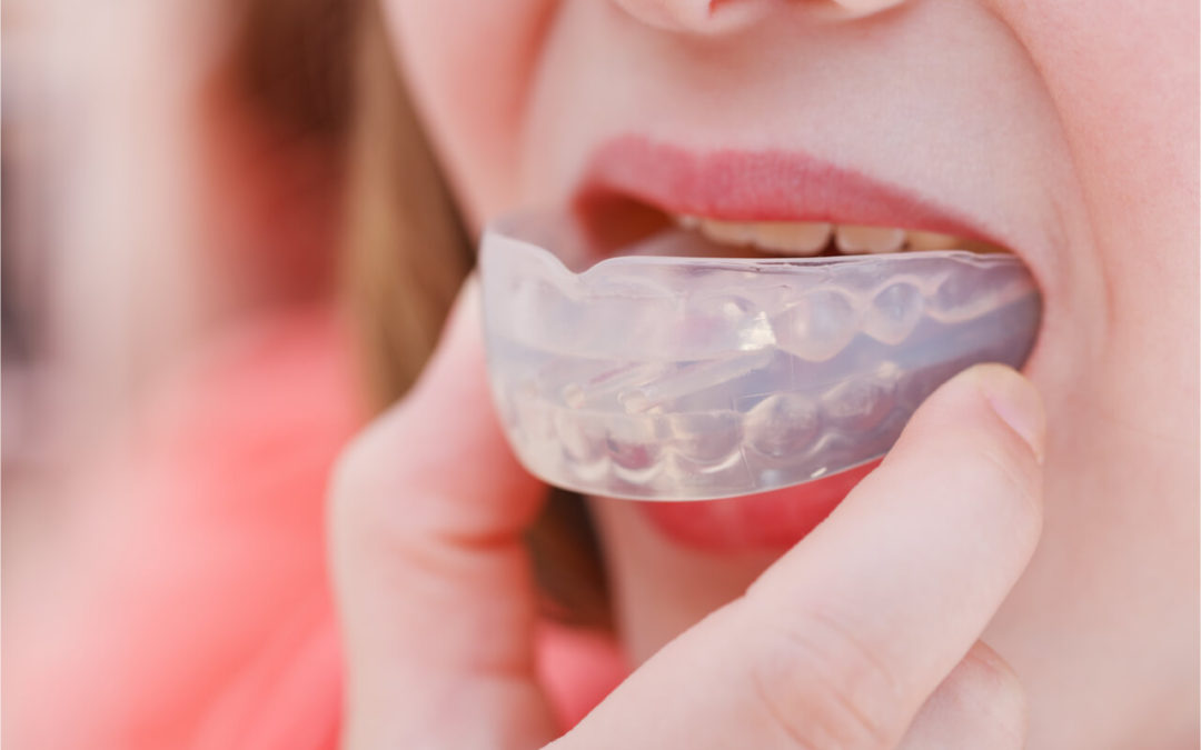 How Does A Custom Hockey Mouthguard Care For Your Dental Health?