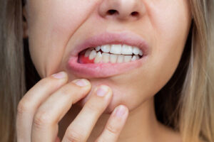 is periodontitis reversible signs