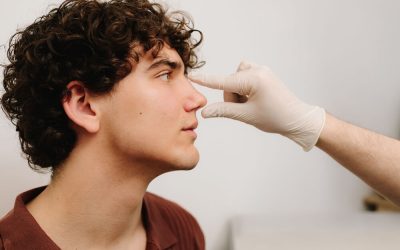 Rhinoplasty Swelling Stages: Navigating Your Recovery Timeline